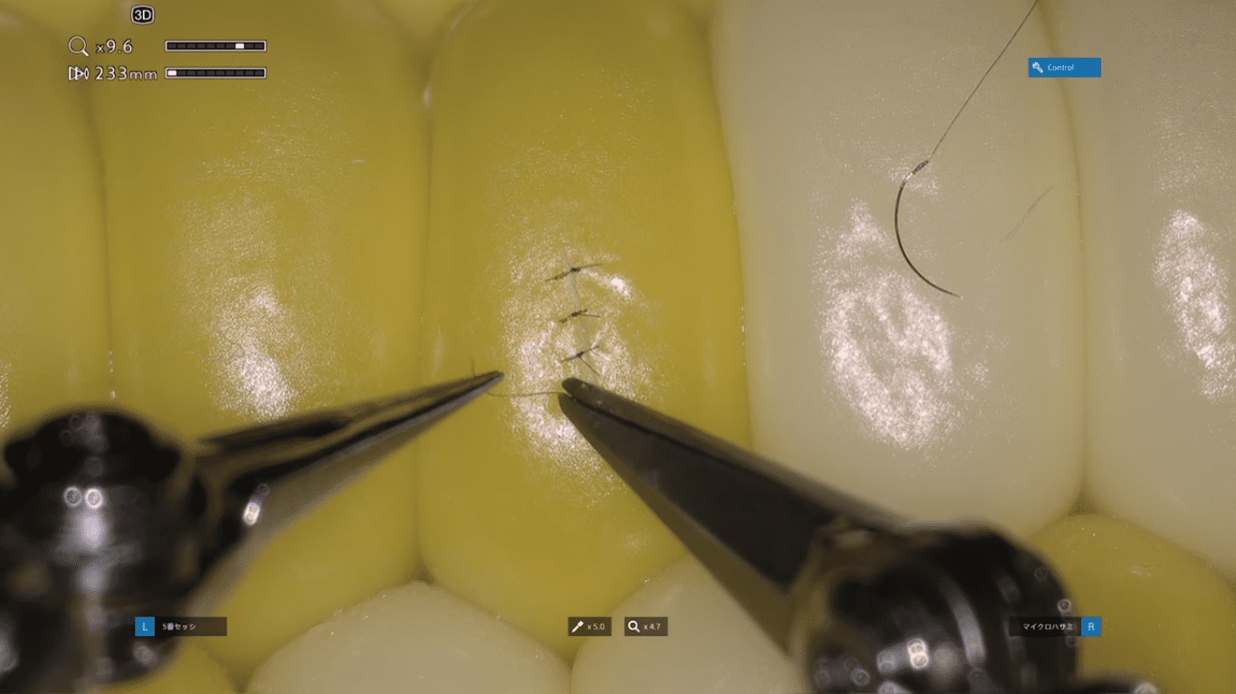 Microchirurgia robotizzata: Sony