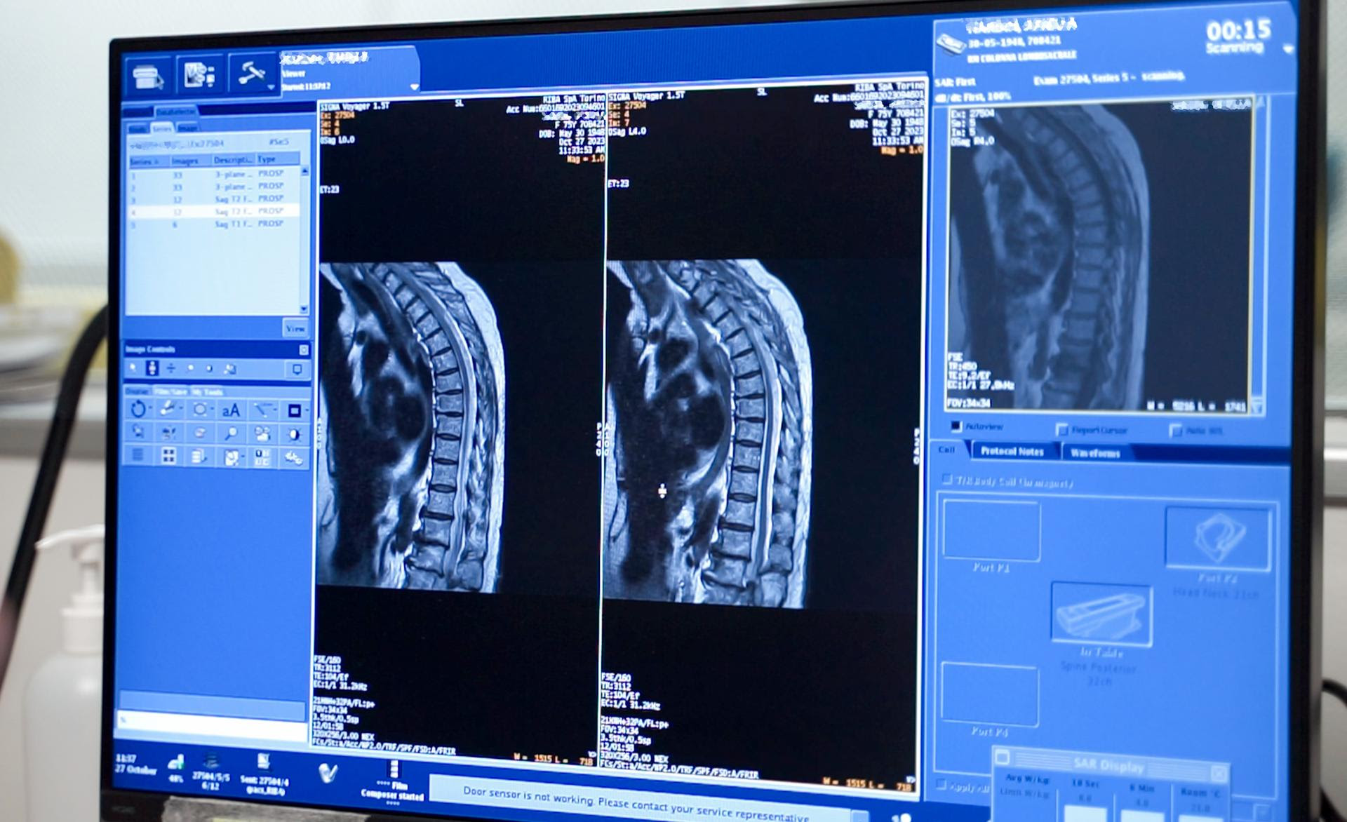 Risonanza Magnetica ad alto campo: nuovo software AI